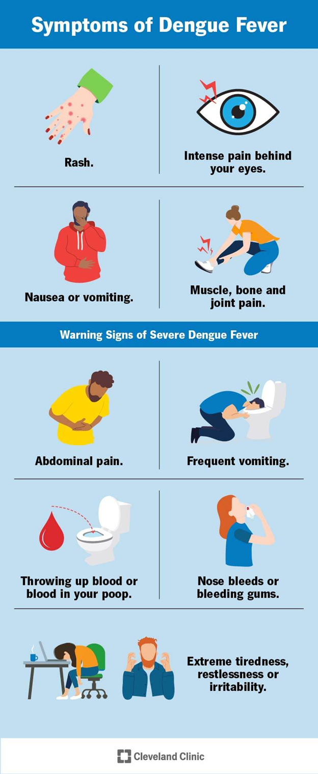 Dengue Fever Symptoms